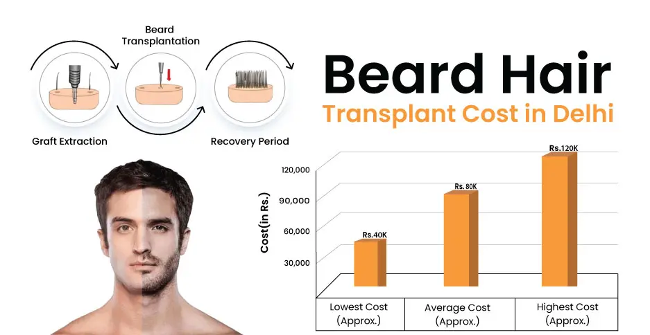 Beard Hair Transplant Cost in Delhi - DMC Trichology
