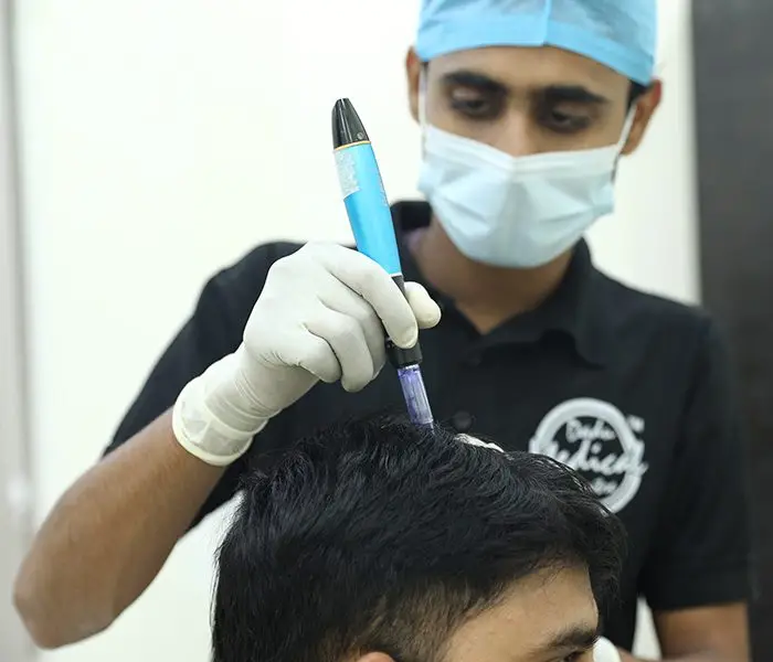 If you are looking for Root Restore therapy in Delhi then visit DMC Trichology.