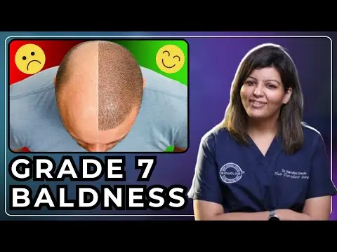 Grade 7 Baldness Video