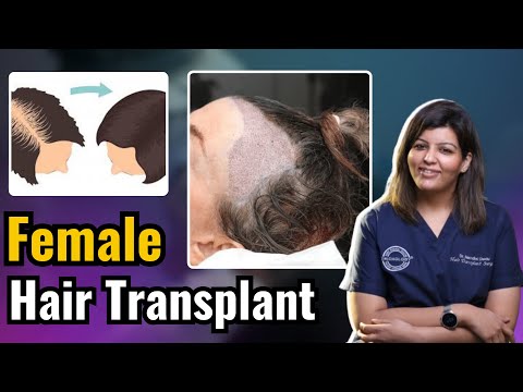 Female Hair Transplant | Good or Bad ? | Dadu Medical Centre